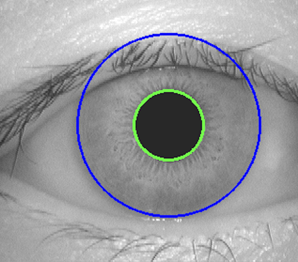 Eye Circular Boundaries